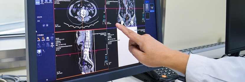 工業(yè)CT無(wú)損檢測(cè)