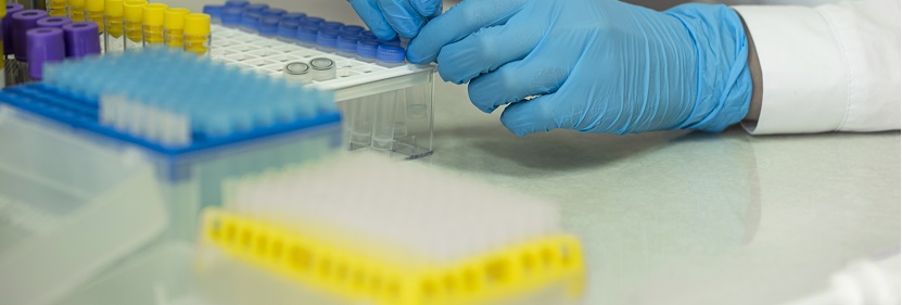 醫(yī)用橡膠塞檢測